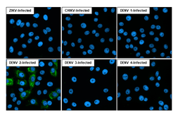 Anti-Dengue virus NS2B protein antibody [HL2512] used in Immunocytochemistry/ Immunofluorescence (ICC/IF). GTX638873